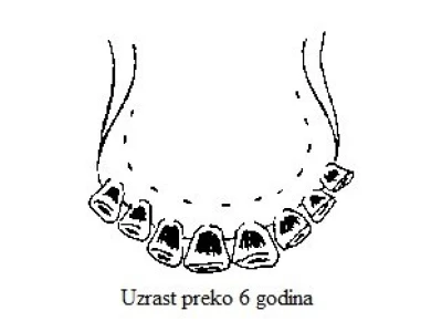 Starost preko 6 godina (trošenje zuba)