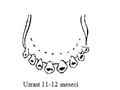Uzrast 11-12 meseci (mlečni zubi)